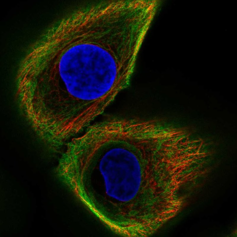 Immunofluorescent staining of human cell line hTCEpi shows localization to intermediate filaments. Antibody staining is shown in green.