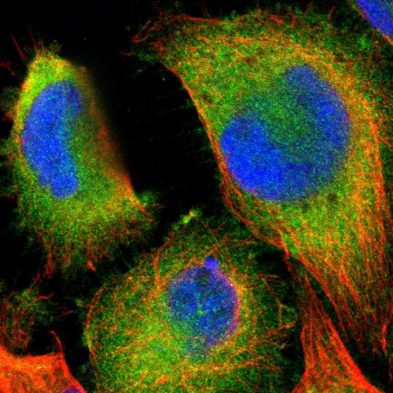 Immunofluorescent staining of human cell line U-251 MG shows localization to cytosol. Antibody staining is shown in green.