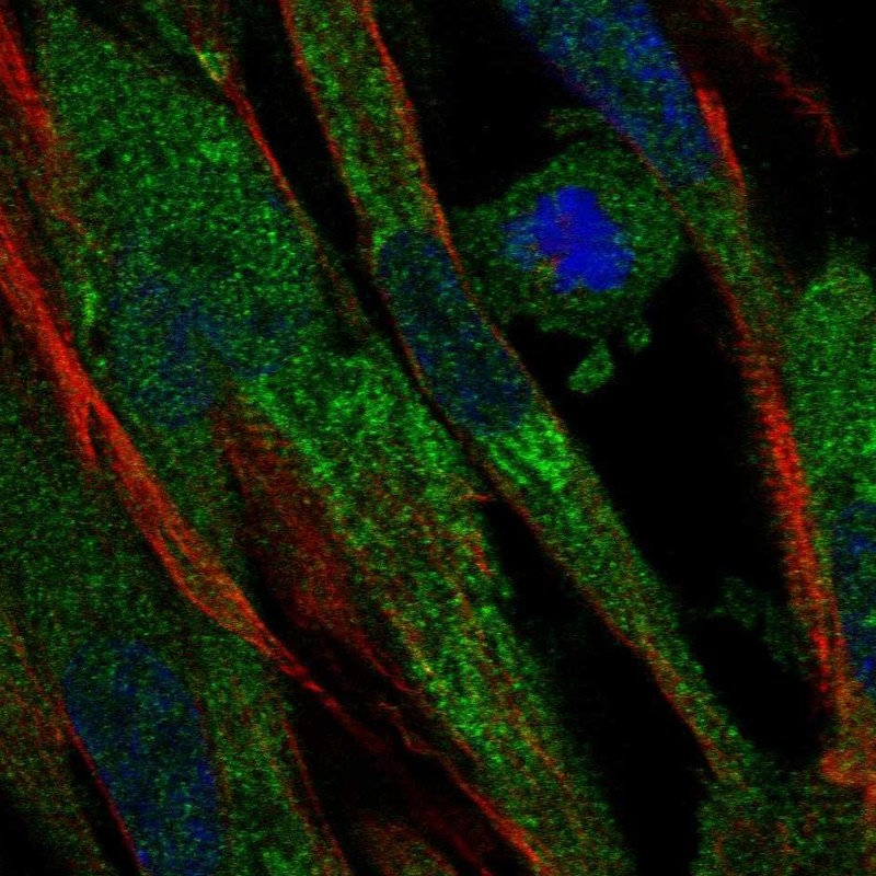 Immunofluorescent staining of human cell line ASC TERT1 shows localization to endoplasmic reticulum. Antibody staining is shown in green.