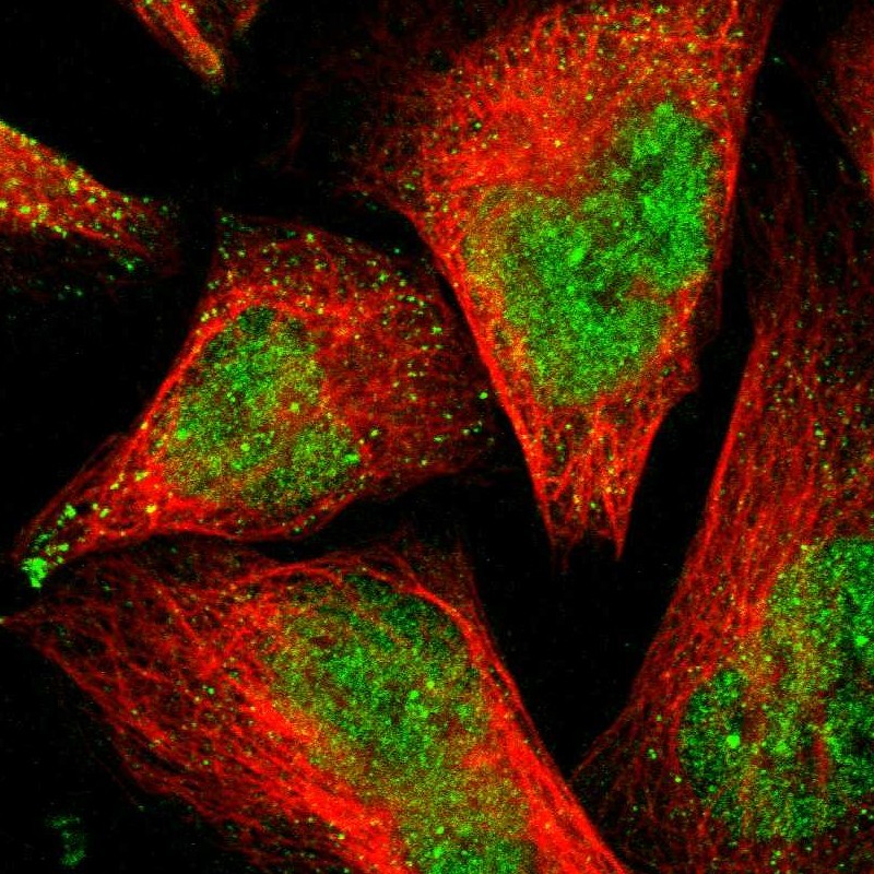 Immunofluorescent staining of human cell line U-2 OS shows localization to nucleoplasm & vesicles. Antibody staining is shown in green.