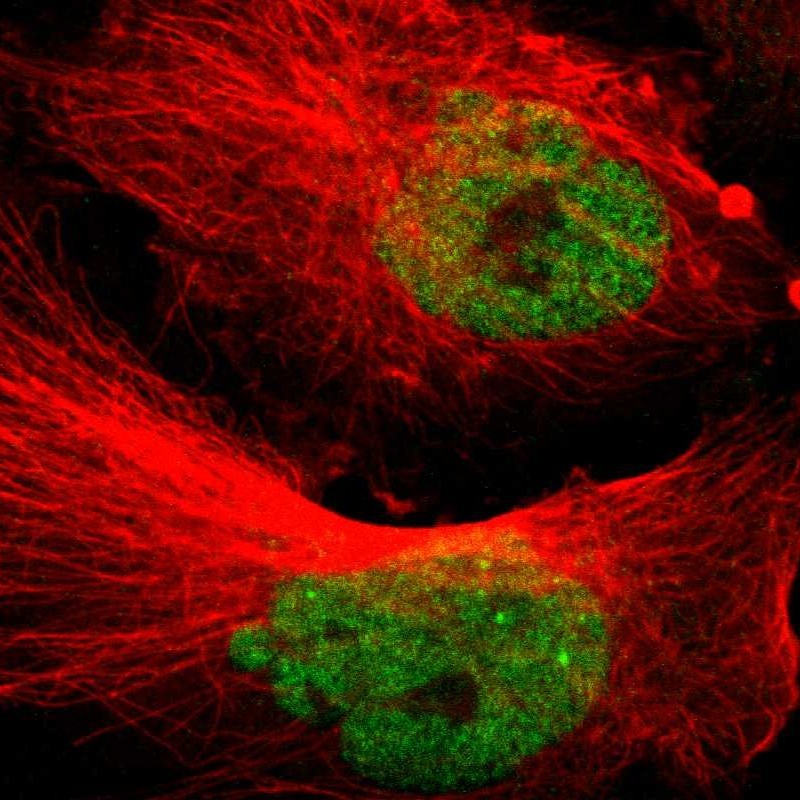 Immunofluorescent staining of human cell line U-251 MG shows localization to nucleoplasm. Antibody staining is shown in green.