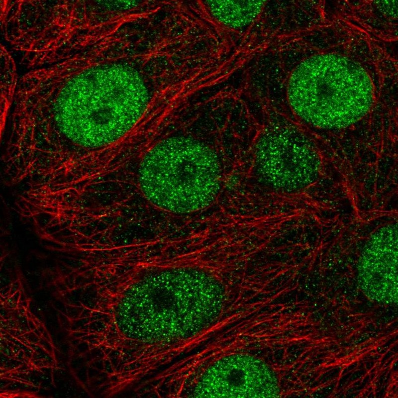 Immunofluorescent staining of human cell line MCF7 shows localization to nucleoplasm. Antibody staining is shown in green.