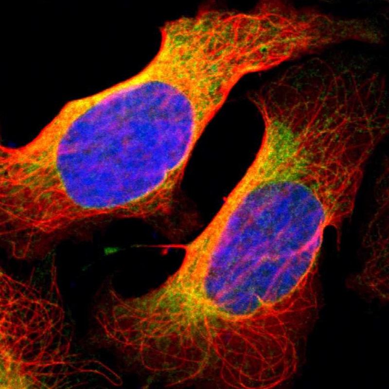 Immunofluorescent staining of human cell line U-2 OS shows localization to endoplasmic reticulum. Antibody staining is shown in green.