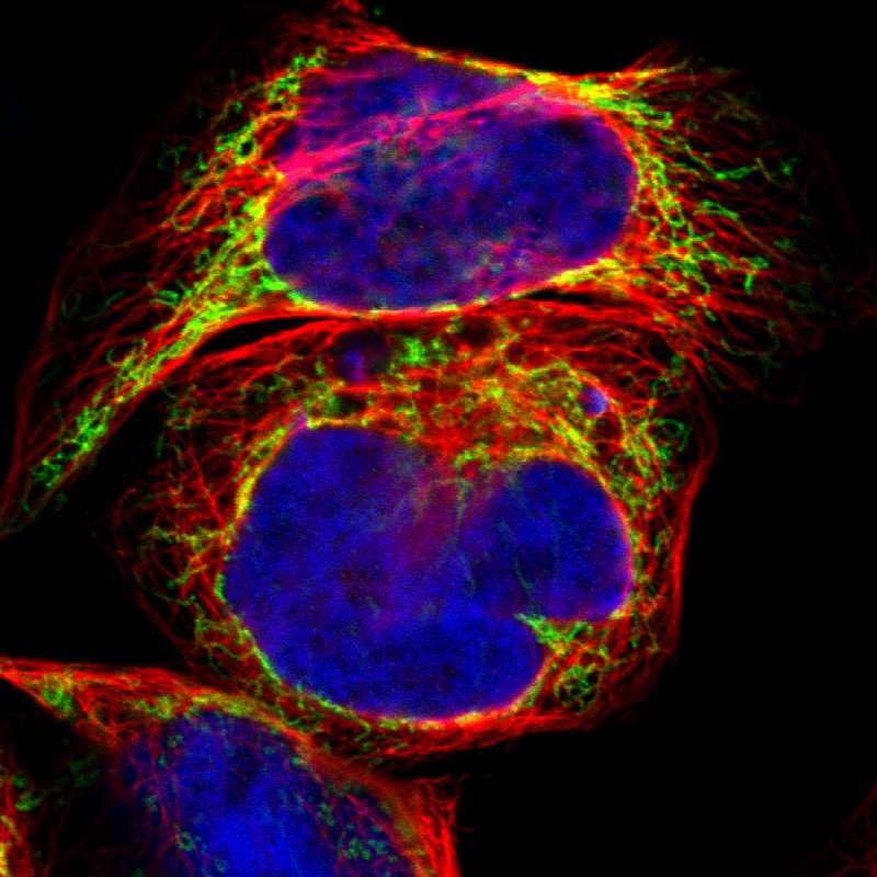 Immunofluorescent staining of human cell line A-431 shows localization to mitochondria. Antibody staining is shown in green.