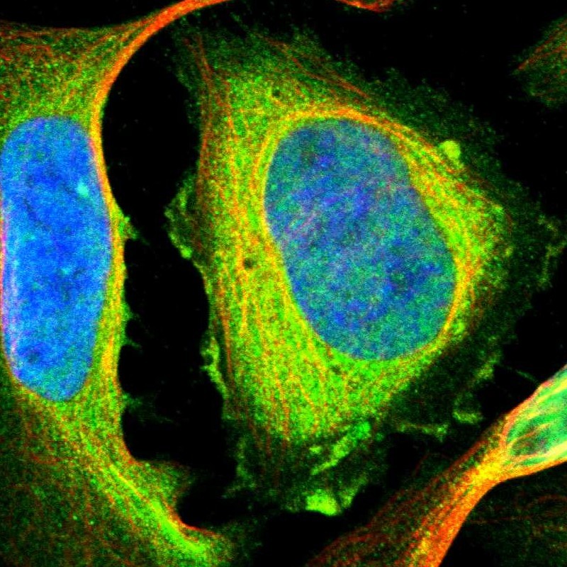 Immunofluorescent staining of human cell line U-2 OS shows localization to plasma membrane & cytosol. Antibody staining is shown in green.