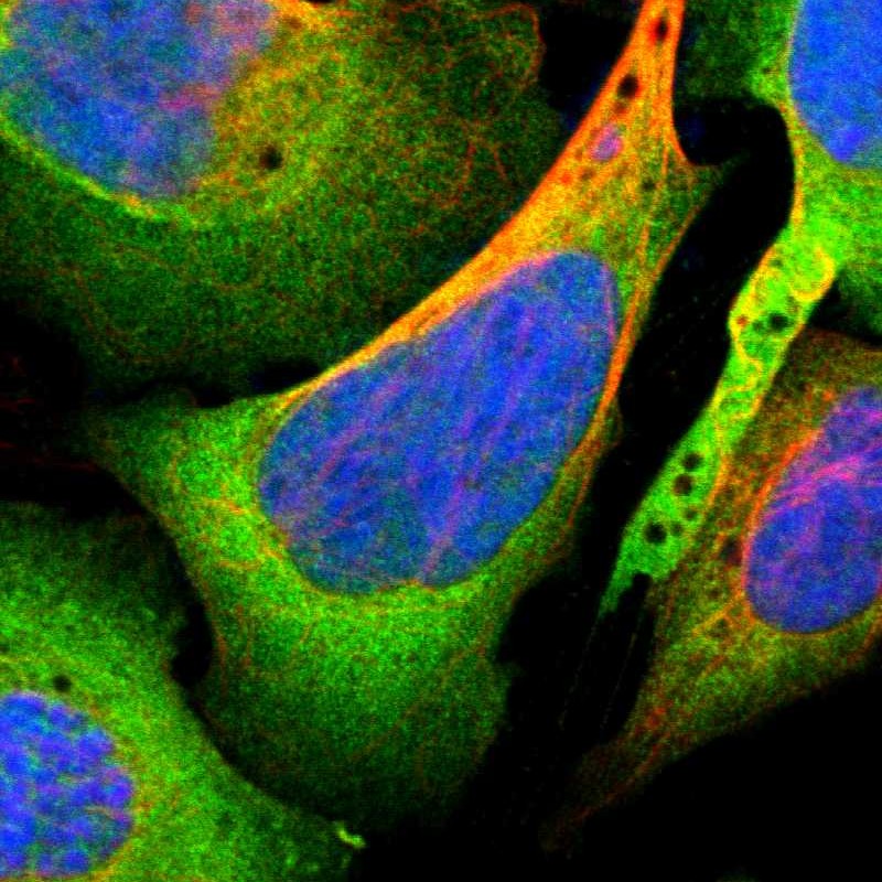 Immunofluorescent staining of human cell line U-2 OS shows localization to cytosol. Antibody staining is shown in green.