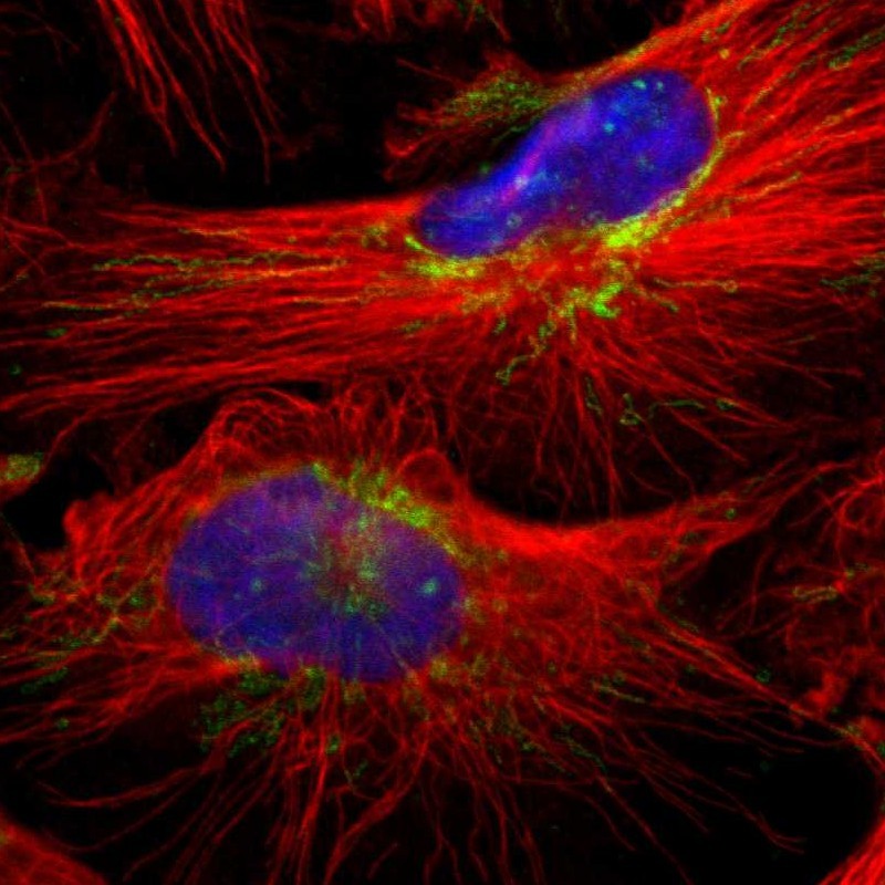 Immunofluorescent staining of human cell line U-251 MG shows localization to nucleoli & mitochondria. Antibody staining is shown in green.