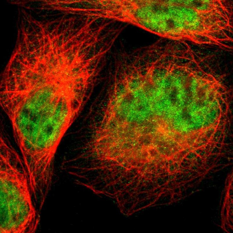 Immunofluorescent staining of human cell line A-431 shows localization to nucleoplasm & cytosol. Antibody staining is shown in green.