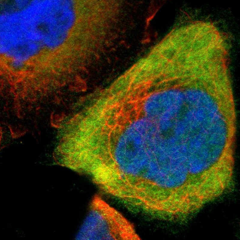 Immunofluorescent staining of human cell line A-431 shows localization to cytosol. Antibody staining is shown in green.