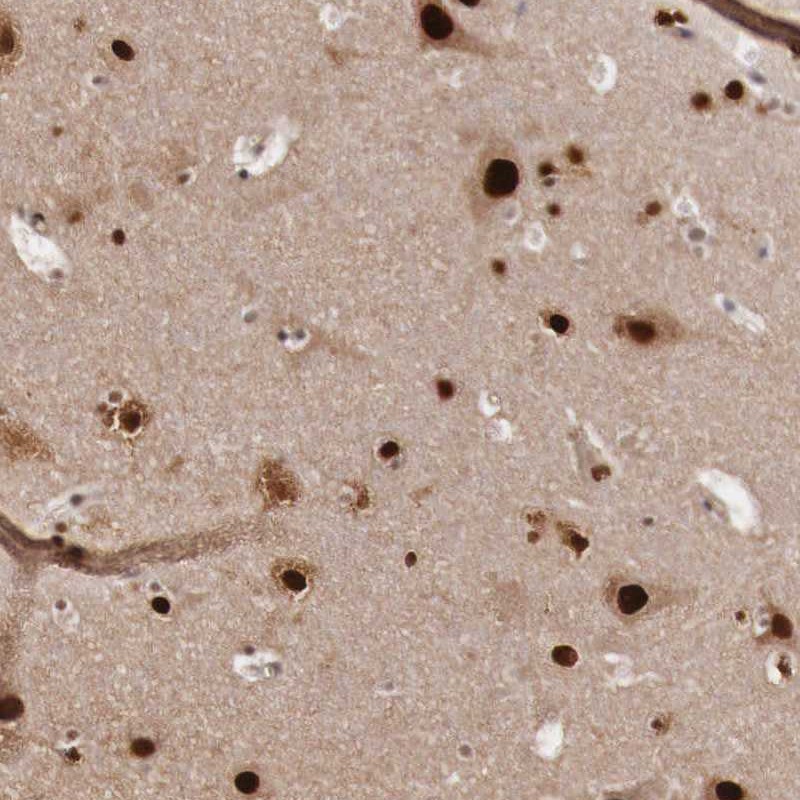 Immunohistochemical staining of human cerebral cortex shows strong nuclear positivity in neuronal cells.