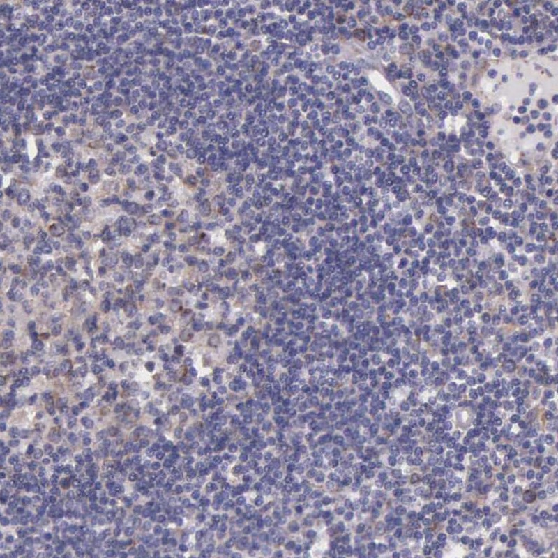 Immunohistochemical staining of human lymph node shows low expression as expected.