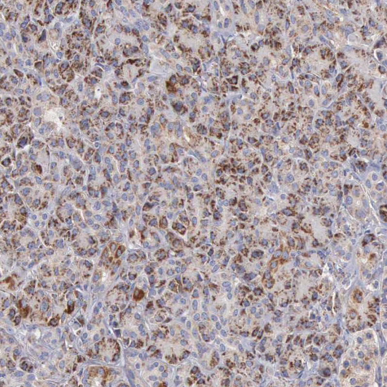 Immunohistochemical staining of human pancreas shows granular cytoplasmic positivity in exocrine glandular cells.