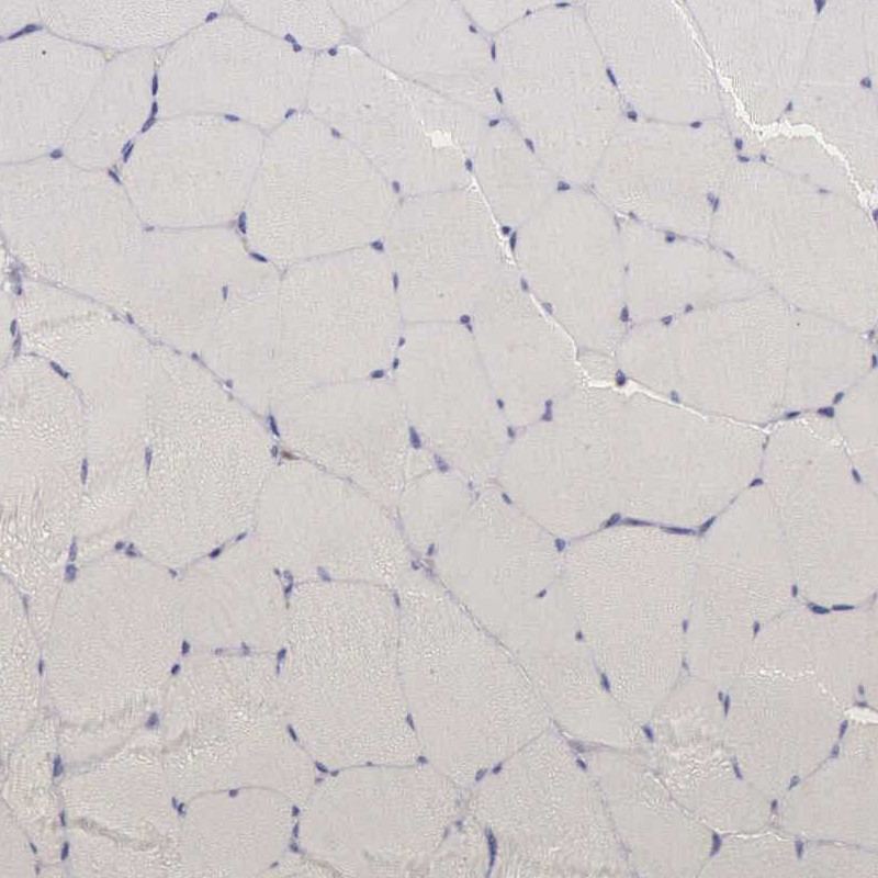 Immunohistochemical staining of human skeletal muscle shows low expression as expected.