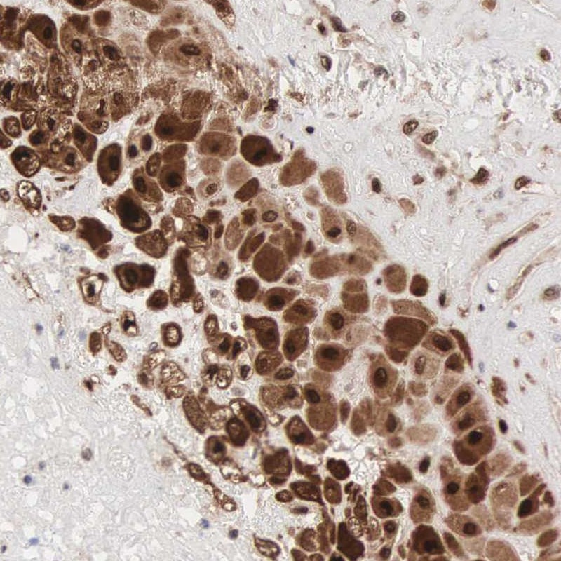 Immunohistochemical staining of human placenta shows strong nuclear and cytoplasmic positivity in decidual cells.