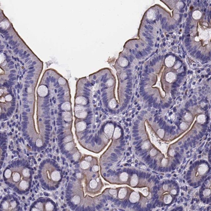 Immunohistochemical staining of human duodenum shows distinct membranous positivity in glandular cells.