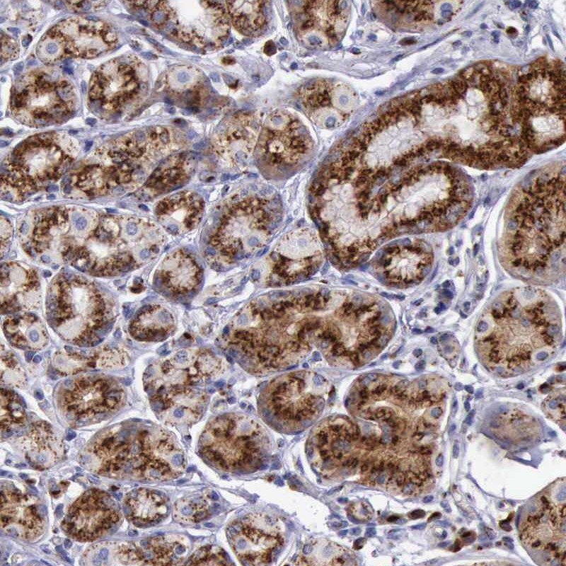 Immunohistochemical staining of human stomach shows strong granular positivity in cytoplasm of glandular cells.