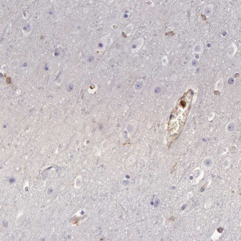 Immunohistochemical staining of human cerebral cortex shows low expression as expected.