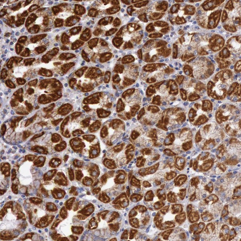 Immunohistochemical staining of human stomach shows strong cytoplasmic positivity in parietal cells.
