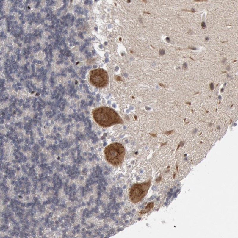 Immunohistochemical staining of human cerebellum shows strong cytoplasmic positivity in Purkinje cells.