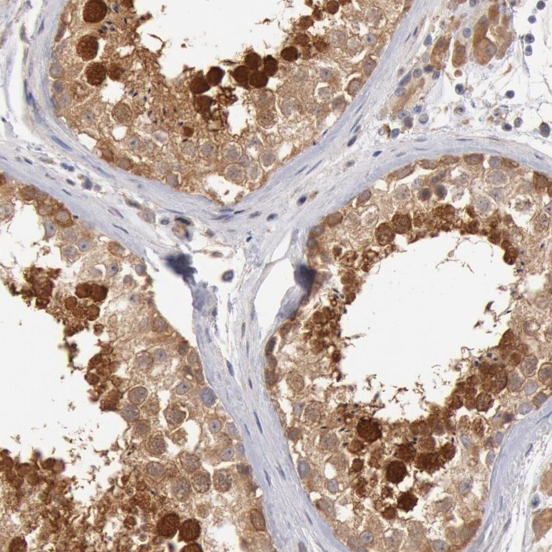 Immunohistochemical staining of human testis shows strong cytoplasmic and nuclear positivity in cells in seminiferus ducts.