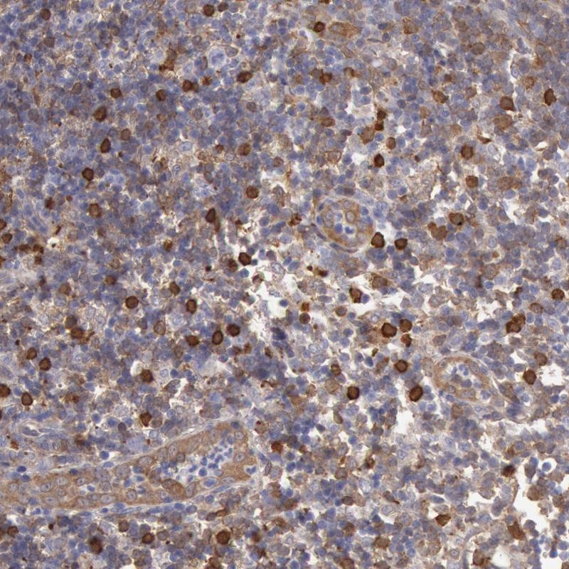 Immunohistochemical staining of human lymph node shows strong cytoplasmic positivity in a subset of lymphoid cells outside reaction center.