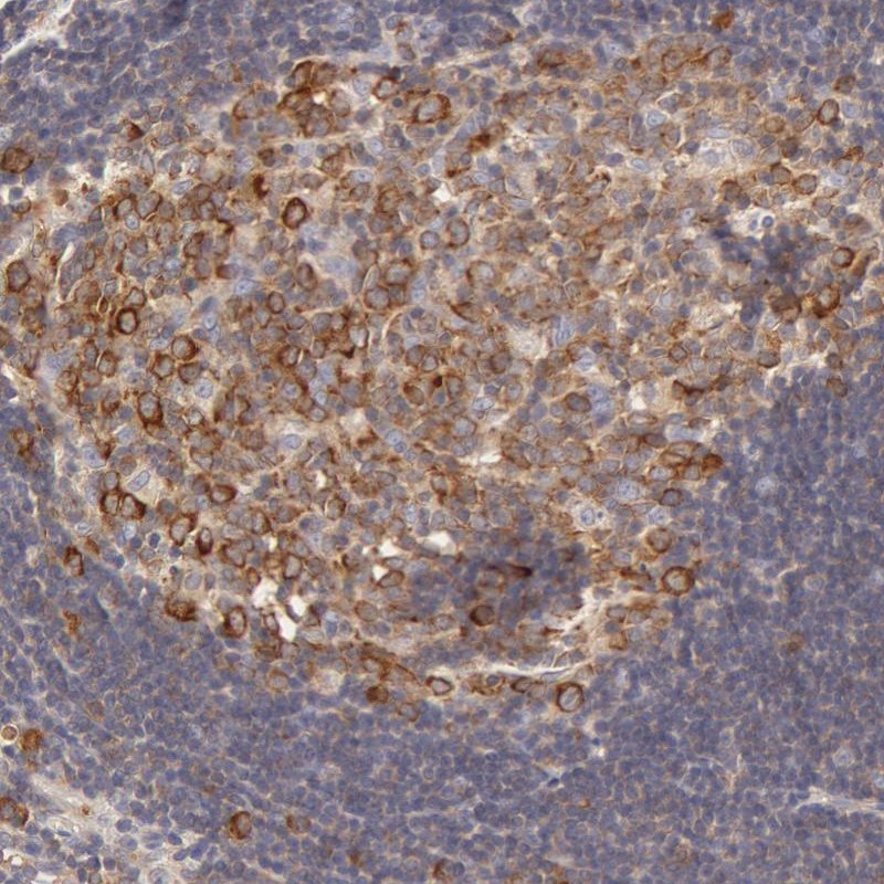 Immunohistochemical staining of human appendix shows strong cytoplasmic positivity in reaction center cells in lymphoid tissue.