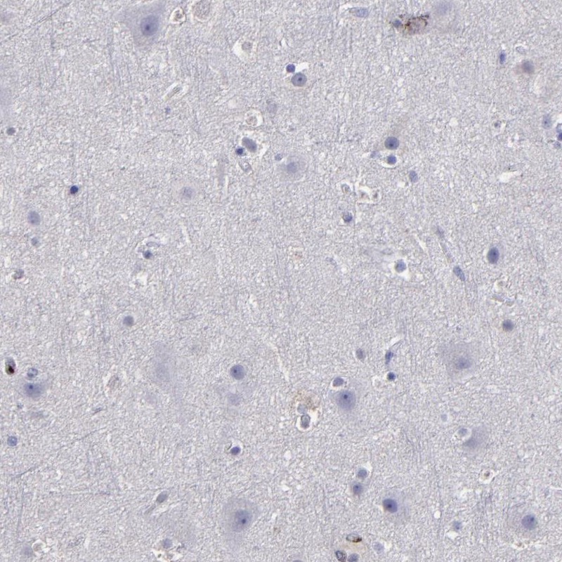 Immunohistochemical staining of human cerebral cortex shows low expression as expected.