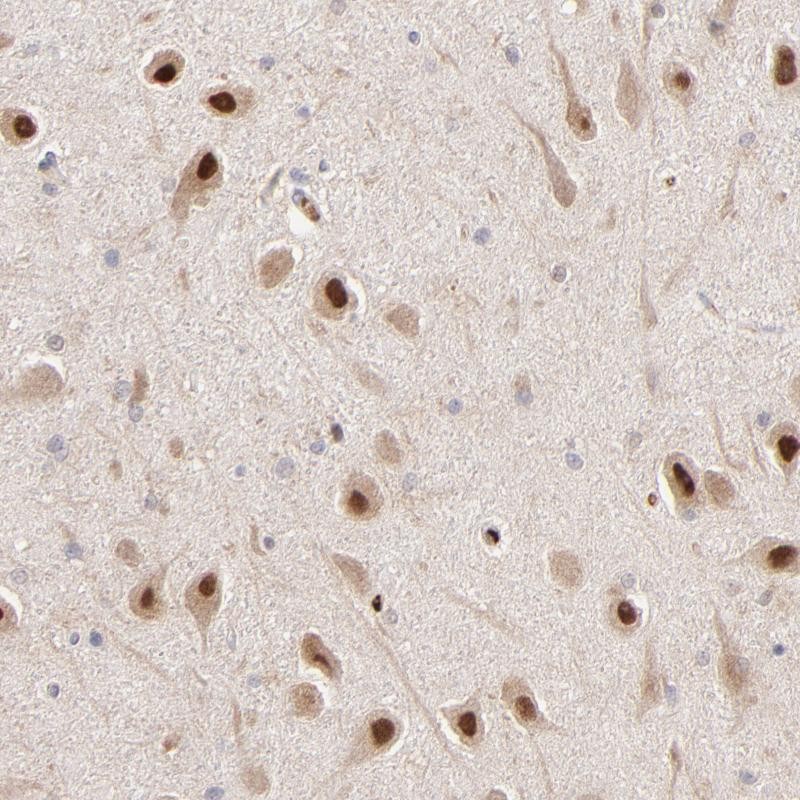 Immunohistochemical staining of human hippocampus shows strong nuclear positivity in neuronal cells.