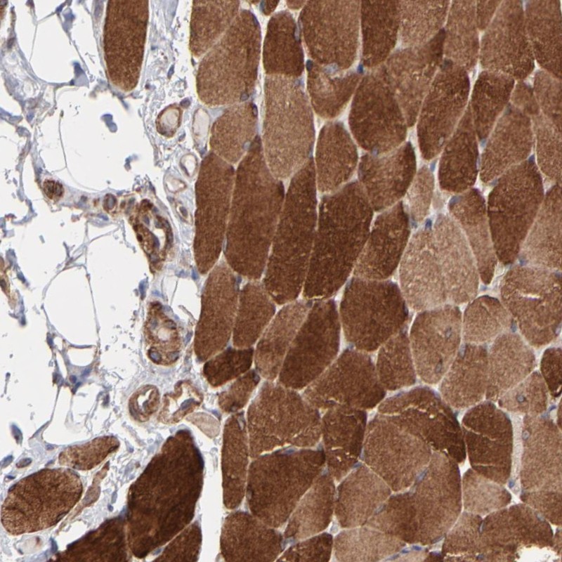 Immunohistochemical staining of human skeletal muscle shows strong cytoplasmic positivity in myocytes.
