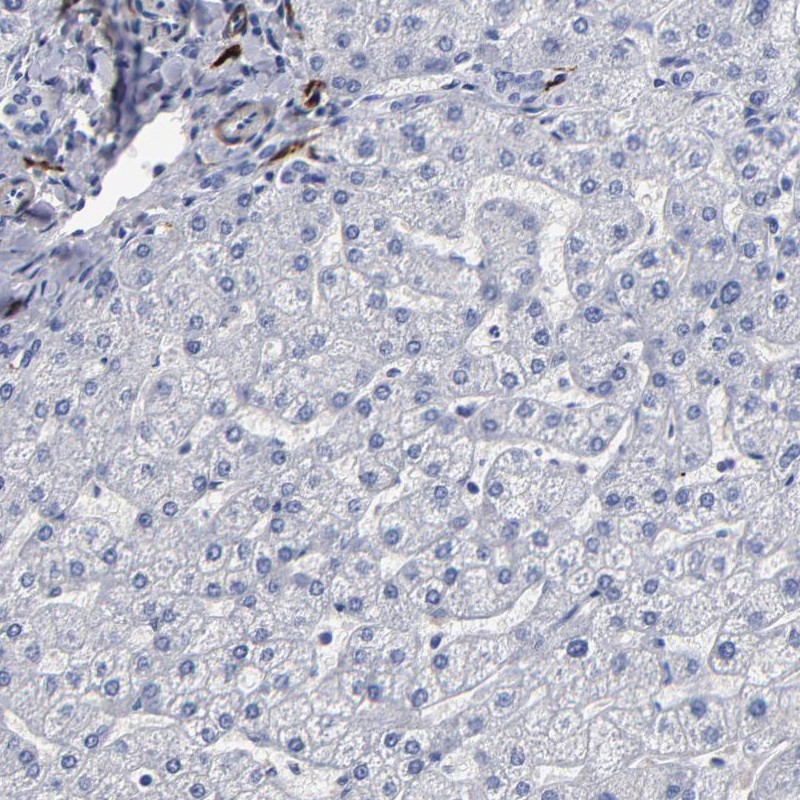 Immunohistochemical staining of human liver shows low expression as expected.