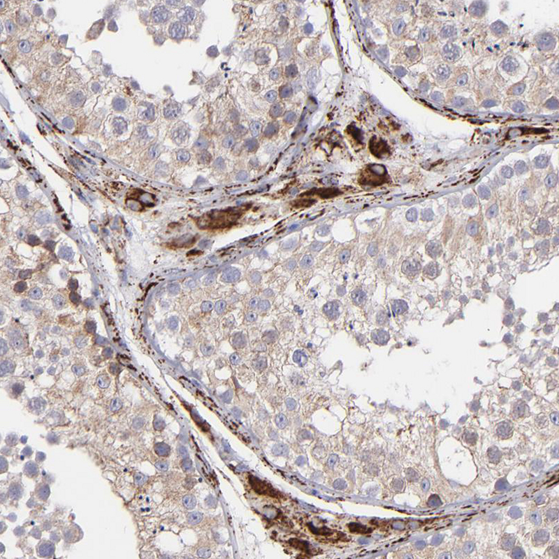 Immunohistochemical staining of human testis shows moderate to strong granular cytoplasmic positivity in Leydig cells.