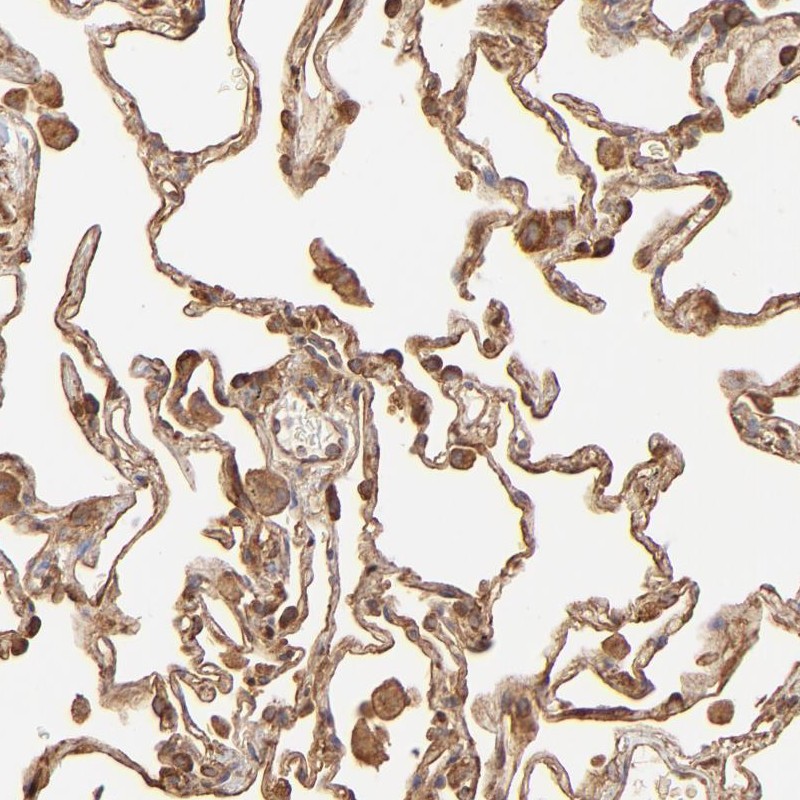 Immunohistochemical staining of human lung shows cytoplasmic and membranous positivity in pneumocytes.