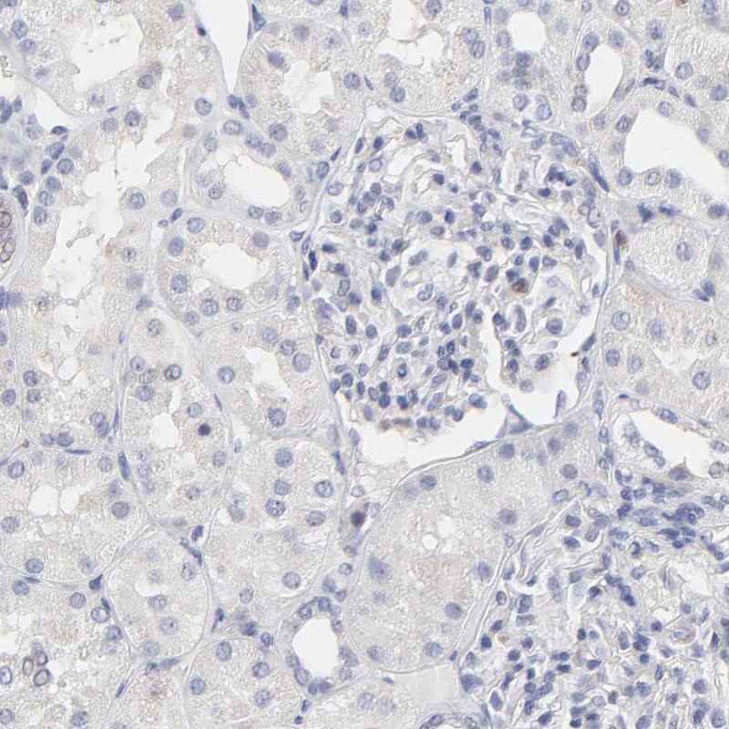 Immunohistochemical staining of human kidney shows low expression as expected.