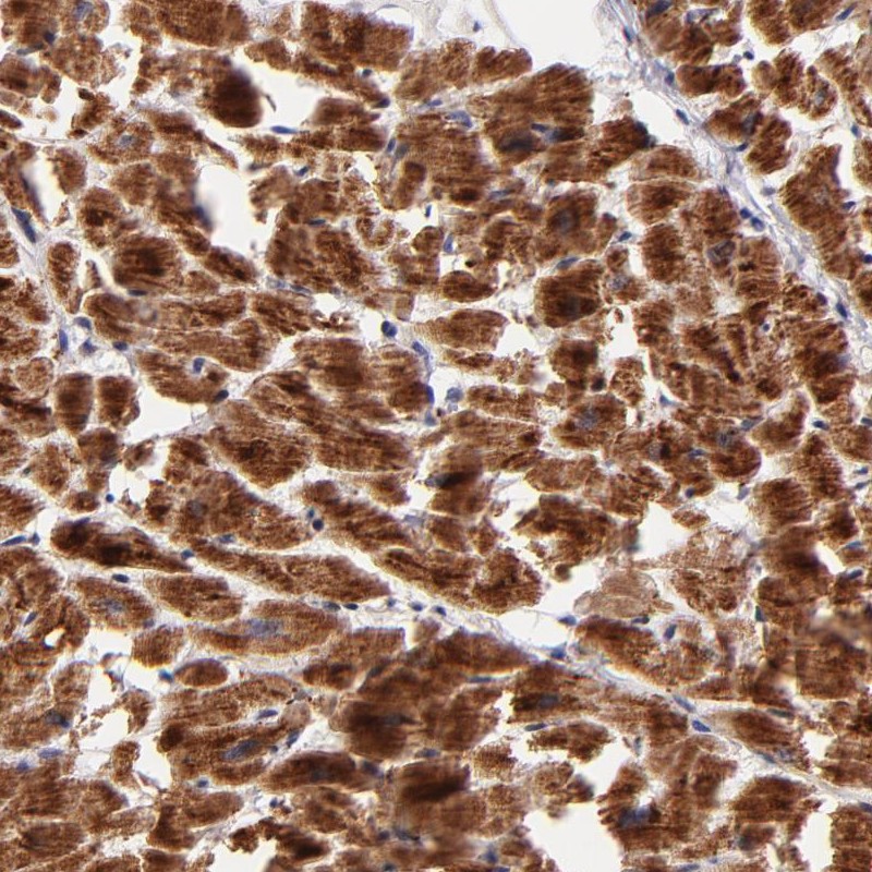 Immunohistochemical staining of human heart muscle shows strong cytoplasmic positivity in myocytes.
