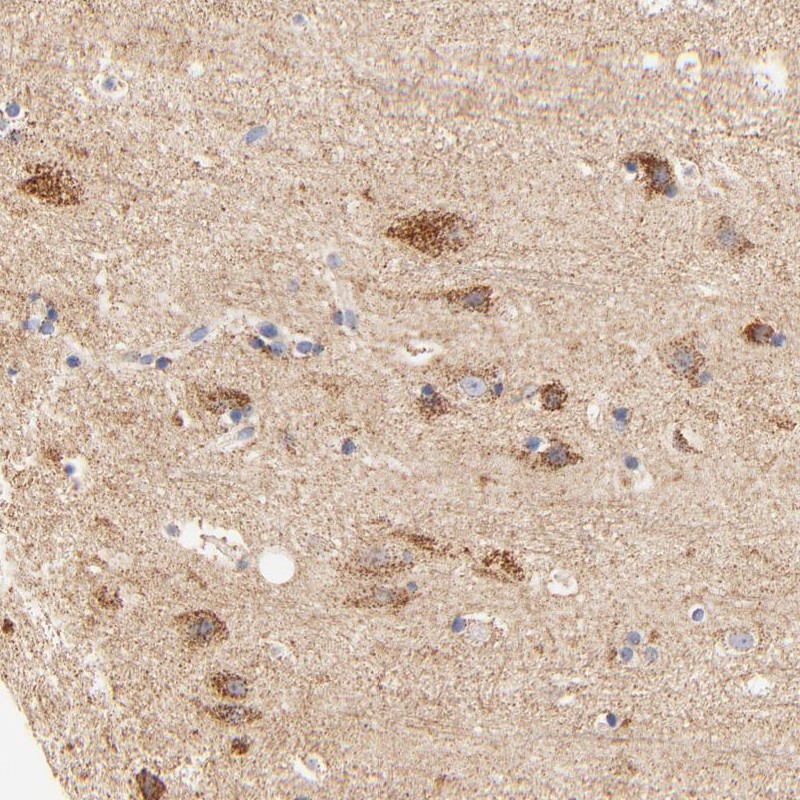 Immunohistochemical staining of human cerebral cortex shows strong cytoplasmic positivity in granular pattern in neuronal cells.