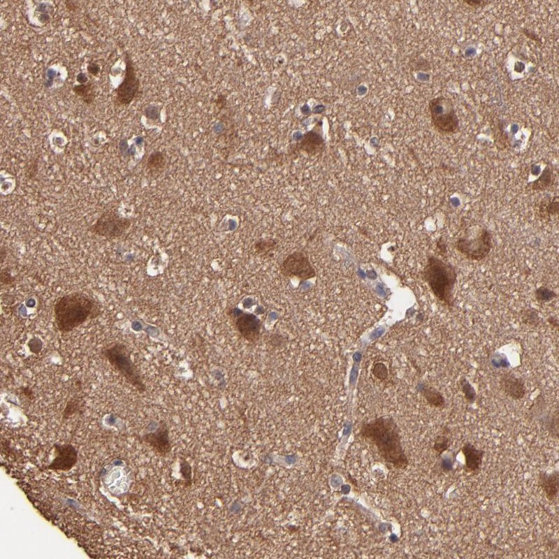 Immunohistochemical staining of human cerebral cortex shows strong cytoplasmic positivity in neuronal cells.