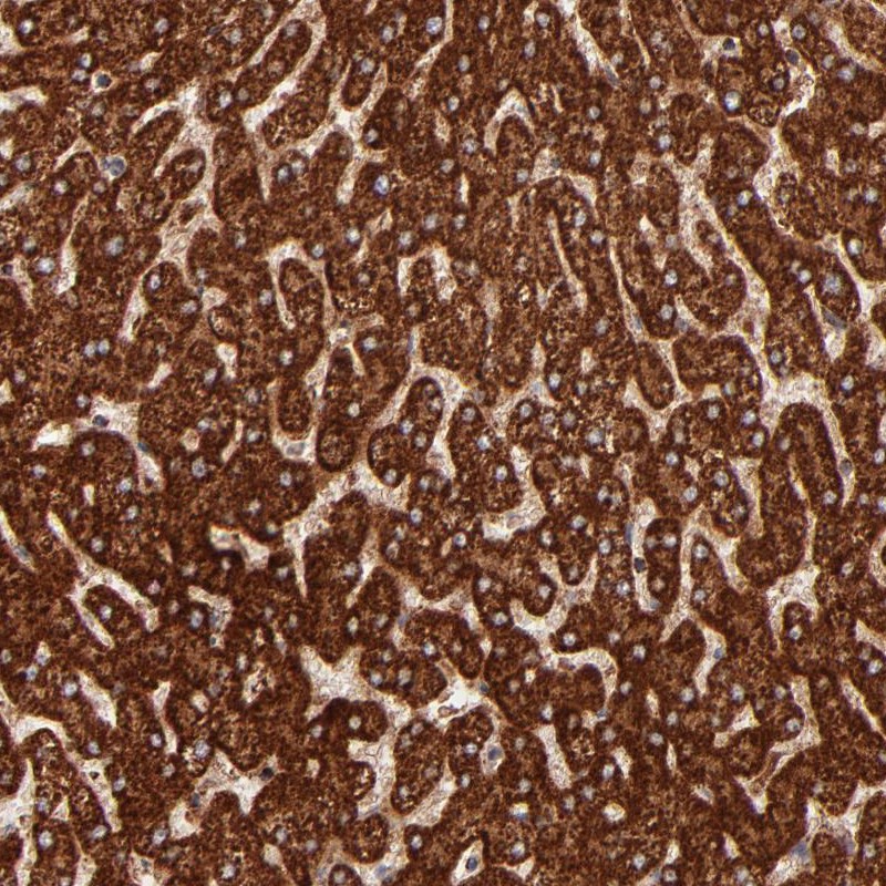Immunohistochemical staining of human liver shows strong cytoplasmic positivity in hepatocytes.