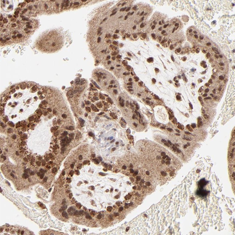 Immunohistochemical staining of human placenta shows strong nuclear and cytoplasmic positivity in trophoblastic cells.
