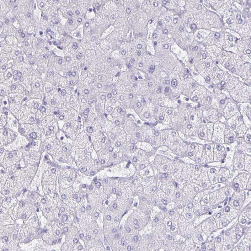 Immunohistochemical staining of human liver shows no positivity as expected.