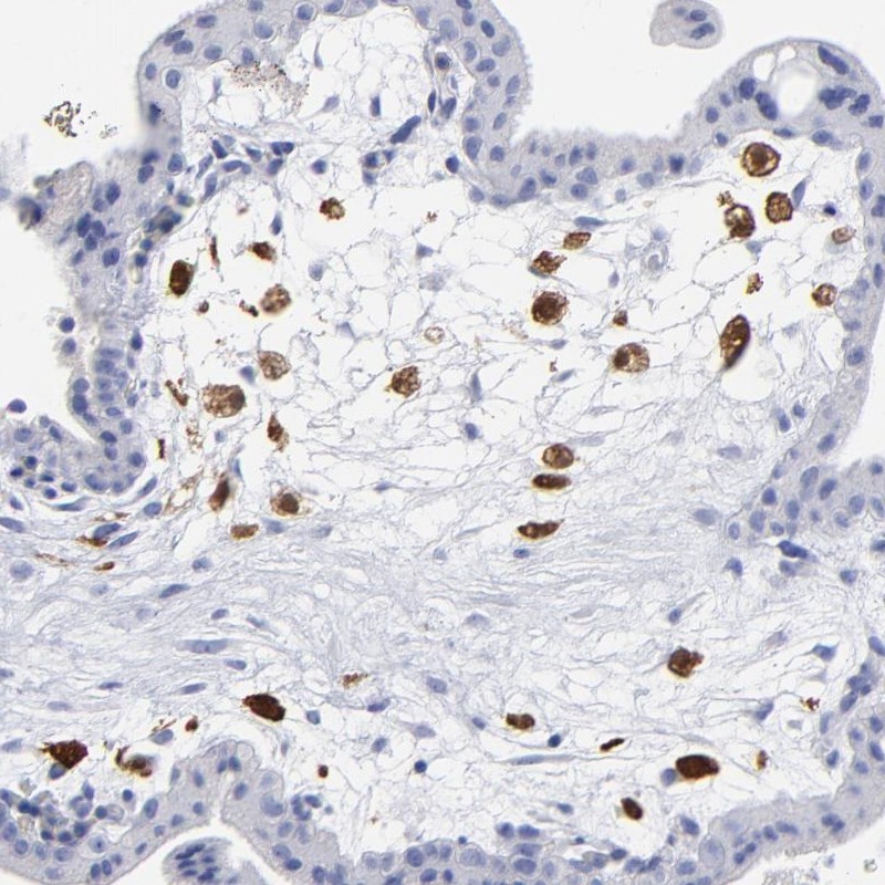 Immunohistochemical staining of human placenta shows distinct positivity in Hofbauer cells.