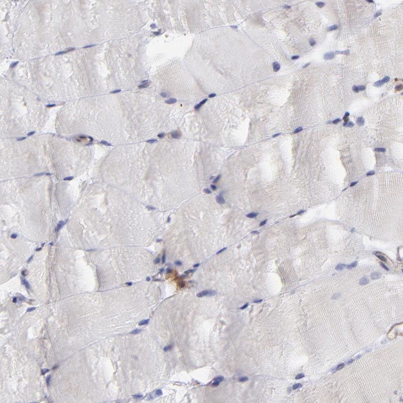 Immunohistochemical staining of human skeletal muscle shows low expression as expected.