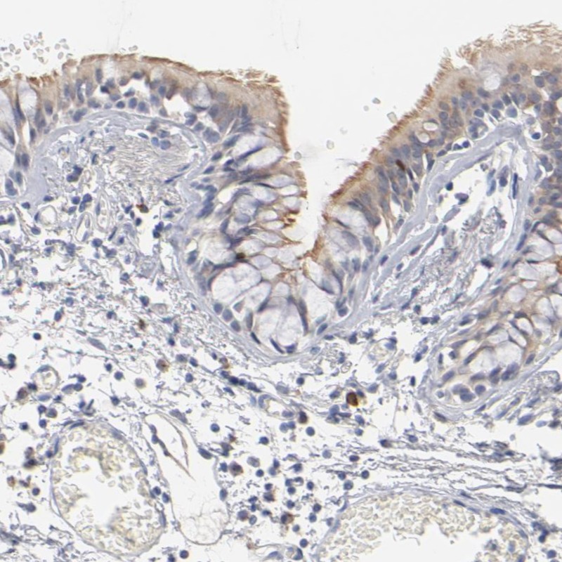 Immunohistochemical staining of human bronchus shows moderate positivity in cilia of respiratory epithelial cells.
