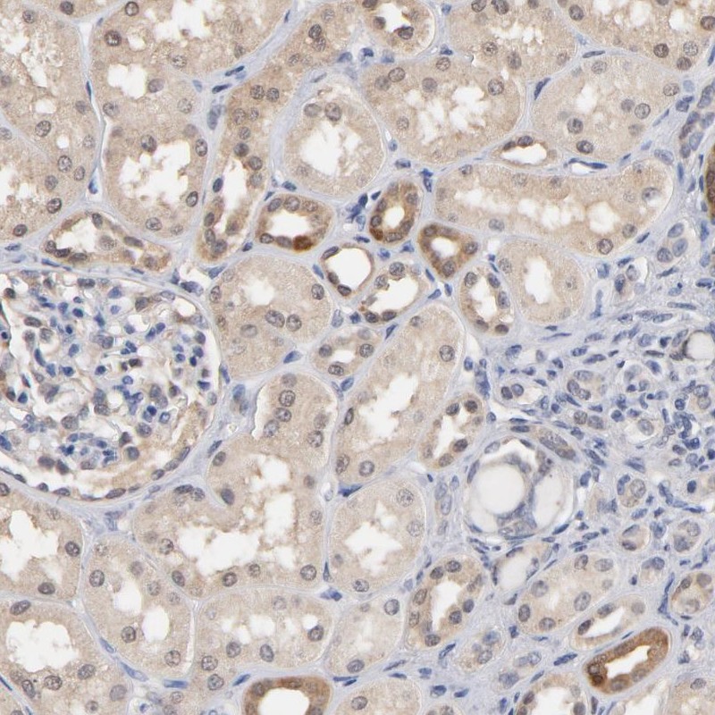Immunohistochemical staining of human kidney shows cytoplasmic positivity.
