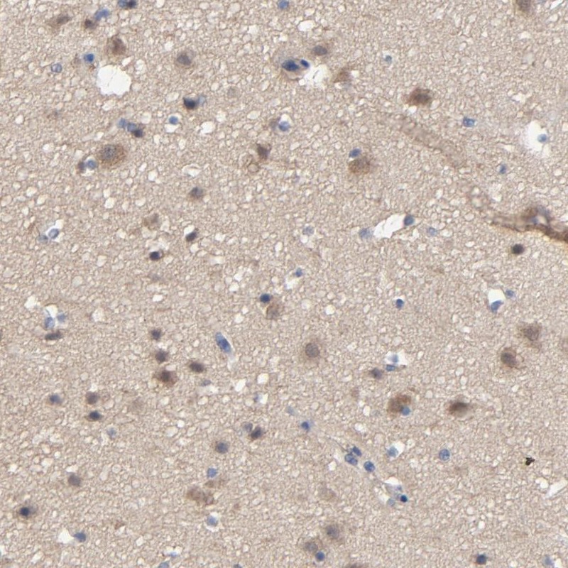 Immunohistochemical staining of human cerebral cortex shows moderate cytoplasmic positivity in neuronal cells, glial cells).