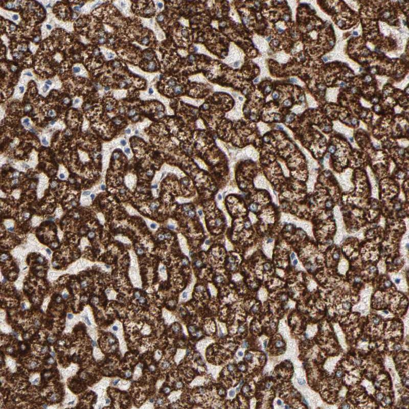 Immunohistochemical staining of human liver shows strong cytoplasmic positivity in hepatocytes.