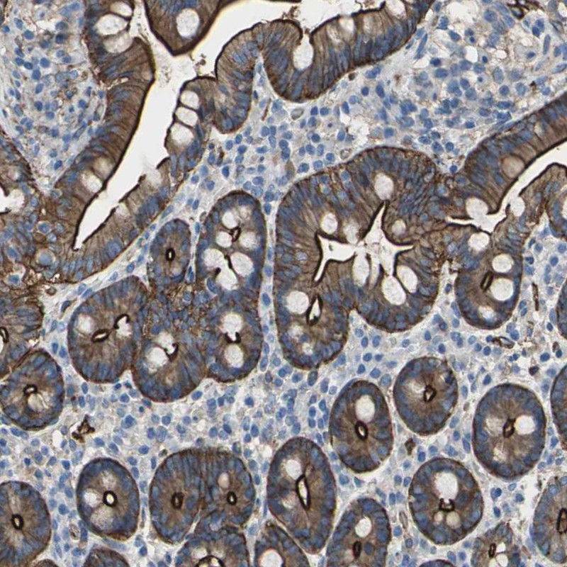 Immunohistochemical staining of human duodenum shows strong membranous and cytoplasmic positivity in glandular cells.
