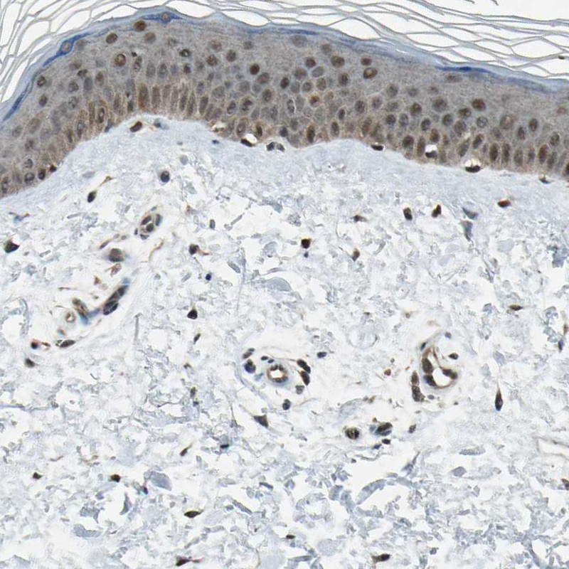Immunohistochemical staining of human skin shows moderate to strong nuclear positivity in epidermal cells.