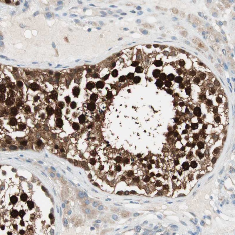 Immunohistochemical staining of human testis shows strong nuclear and cytoplasmic positivity in cells of seminiferus ducts.