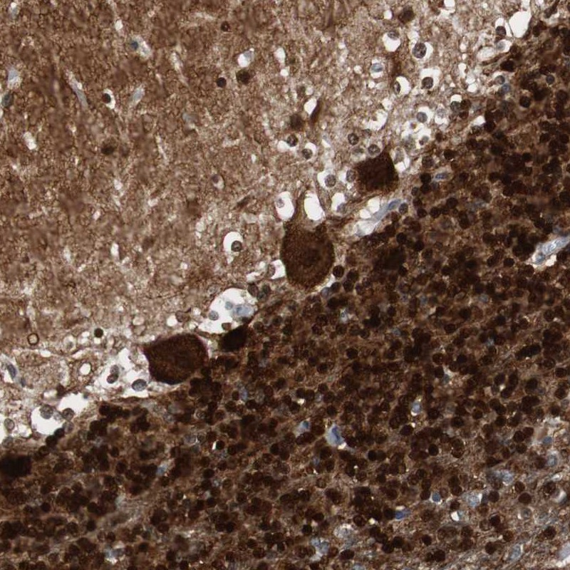 Immunohistochemical staining of human cerebellum shows strong nuclear and cytoplasmic positivity in Purkinje cells and strong nuclear in cells in molecular layer.