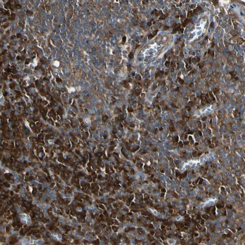 Immunohistochemical staining of human tonsil shows strong cytoplasmic positivity in non-germinal center cells.